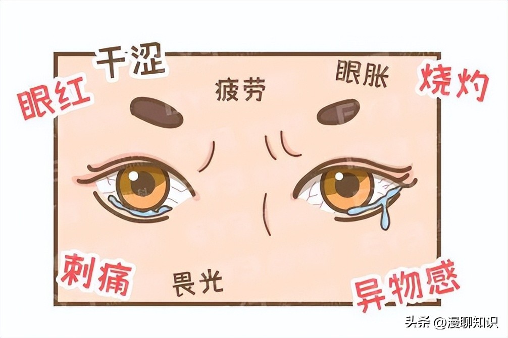 干眼就是干燥综合症吗,眼干涩视物模糊得了干眼怎么办