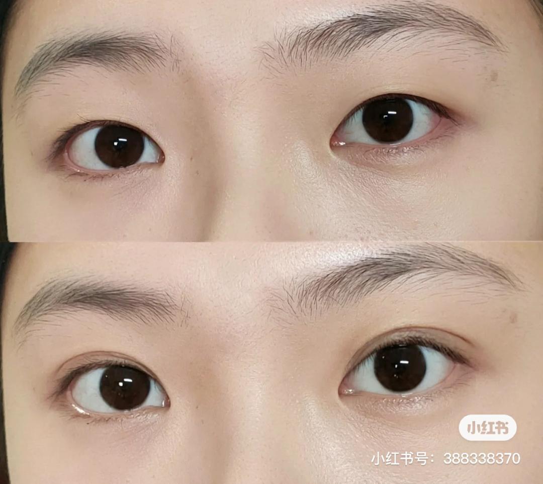 女生为了变美到底有多假动漫版,女生为了变美做整容手术