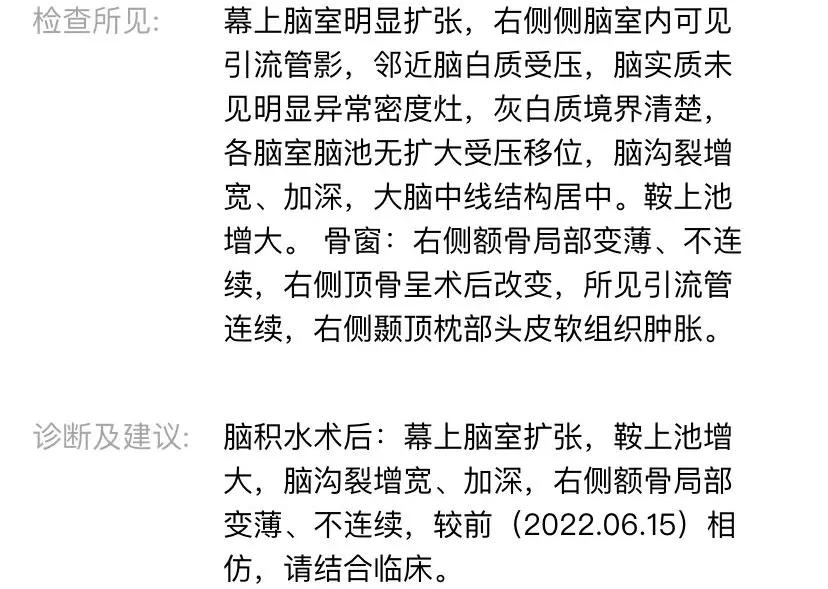 医生一转遥控器,我脑袋里的水就自动流进了肚子