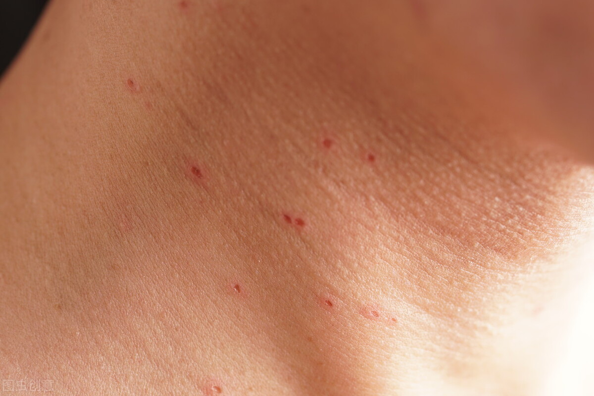 夫妻同时感染病毒,夫妻双双感染新冠