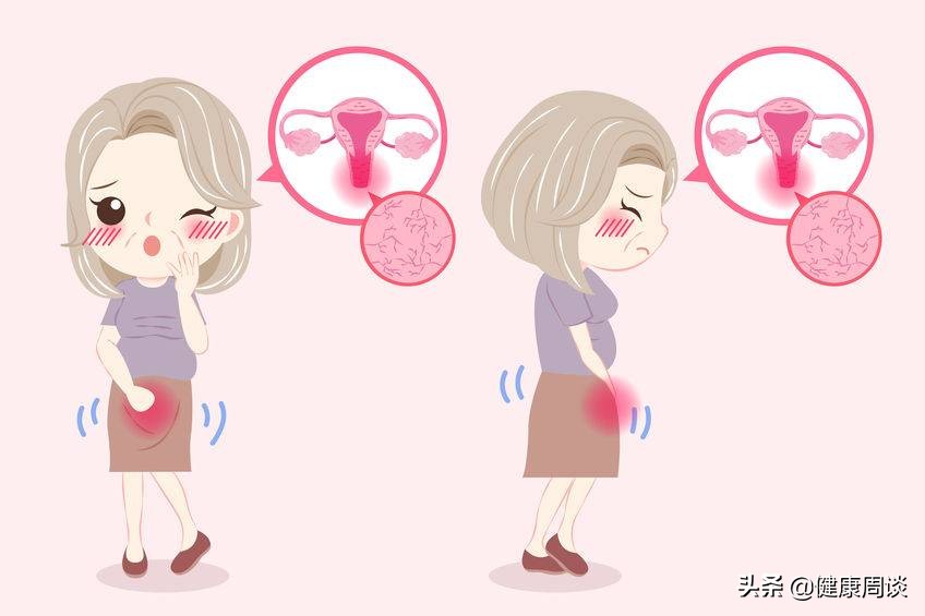为何霉菌性阴道炎偏偏找上你？医生：多半与3件事有关，需警惕