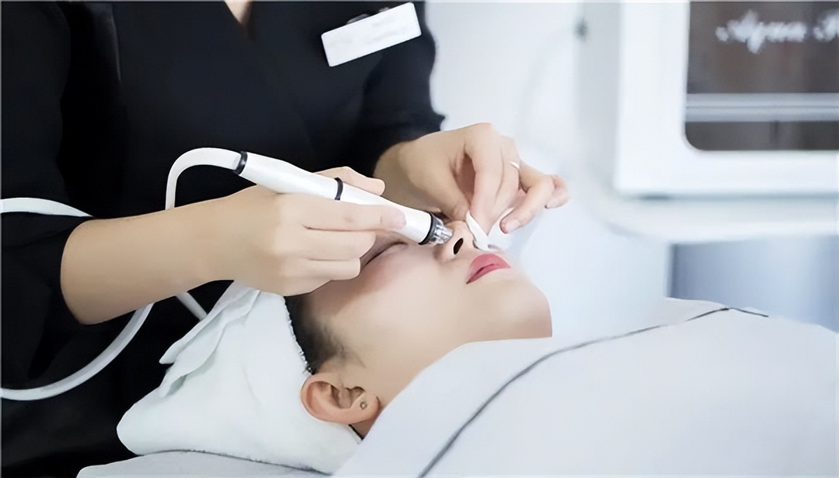 悟空祛痘青春痘能去吗,悟空祛痘毛囊净化效果怎样