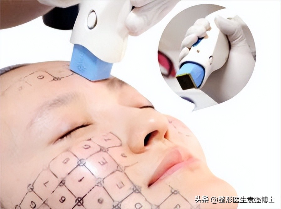 脸部下垂法令纹最有效的办法,改善脸部下垂法令纹最好的方法