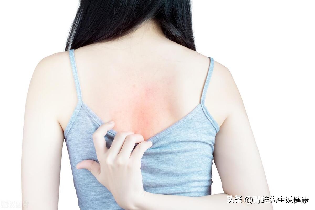 夏季皮肤瘙痒如何缓解,湿热引起的皮肤瘙痒怎么办