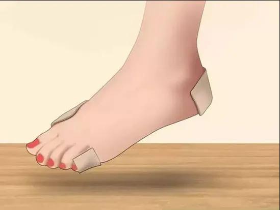 脚底破皮需要把皮撕掉吗,脚上破皮了可以不把皮撕掉吗