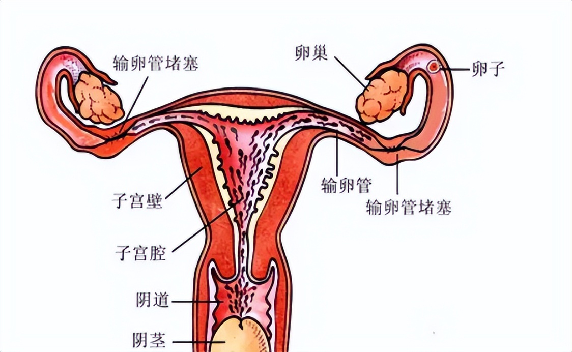 女人输卵管堵塞怎么办,怎样证明输卵管是通的