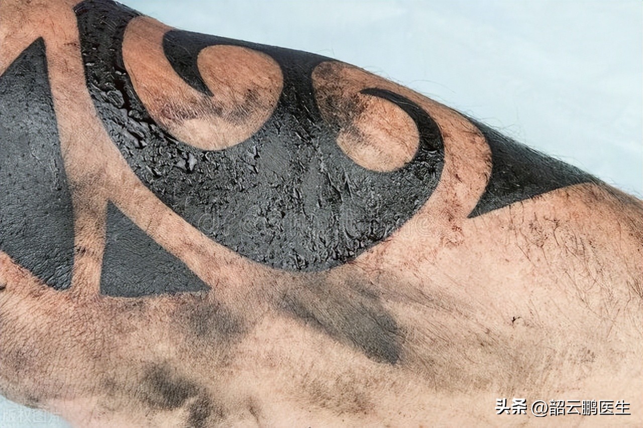 艾滋病科普小知识什么是艾滋病,艾滋病是什么病这么可怕吗