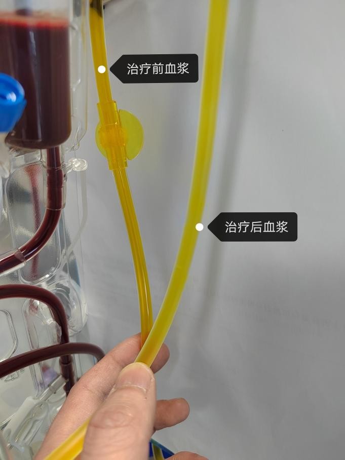 西安市红会医院重症监护室主任,西安市红会医院重症医学科