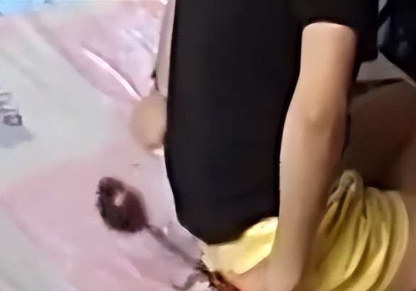 女孩单位体检时少一个肾最后结果,入职体检查出少个肾