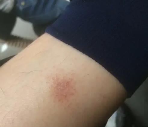 归脾丸的五大奇效和副作用,归脾丸除了健脾还能治四种疾病