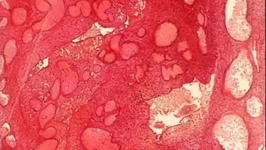 已婚女性容易得的妇科病,已婚妇女一般会得妇科病吗