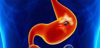 胃不舒服胃酸怎么缓解,大吃大喝过后怎么补救