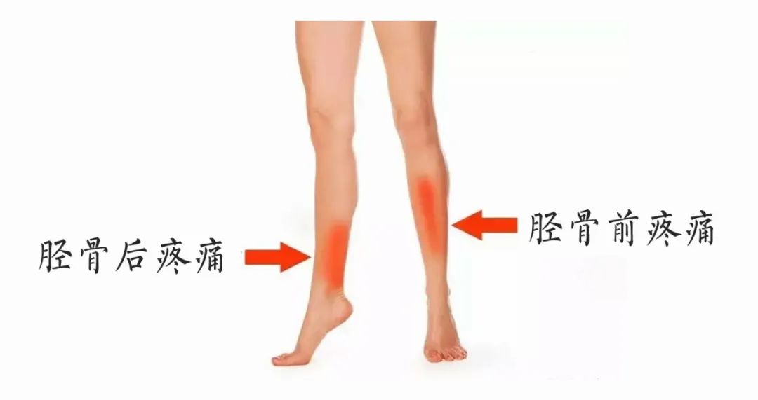 跑步跳绳小腿疼怎么办,跑步小腿前骨疼怎么办