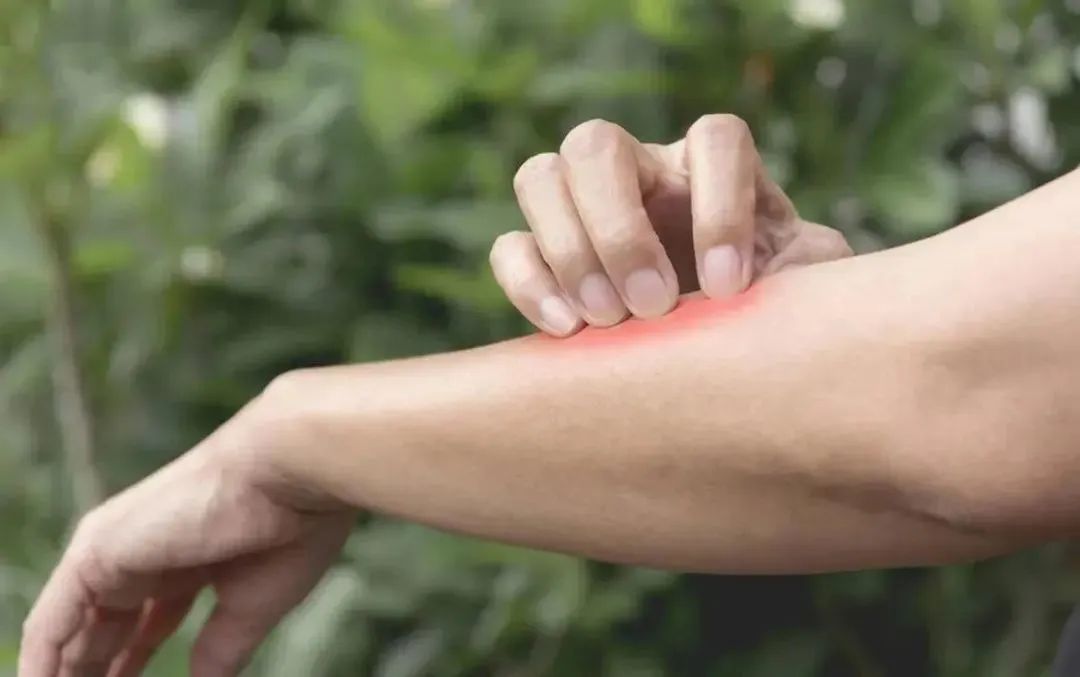 家里出现蚂蚁应该怎样应对,家里有蚂蚁教你一招彻底消灭