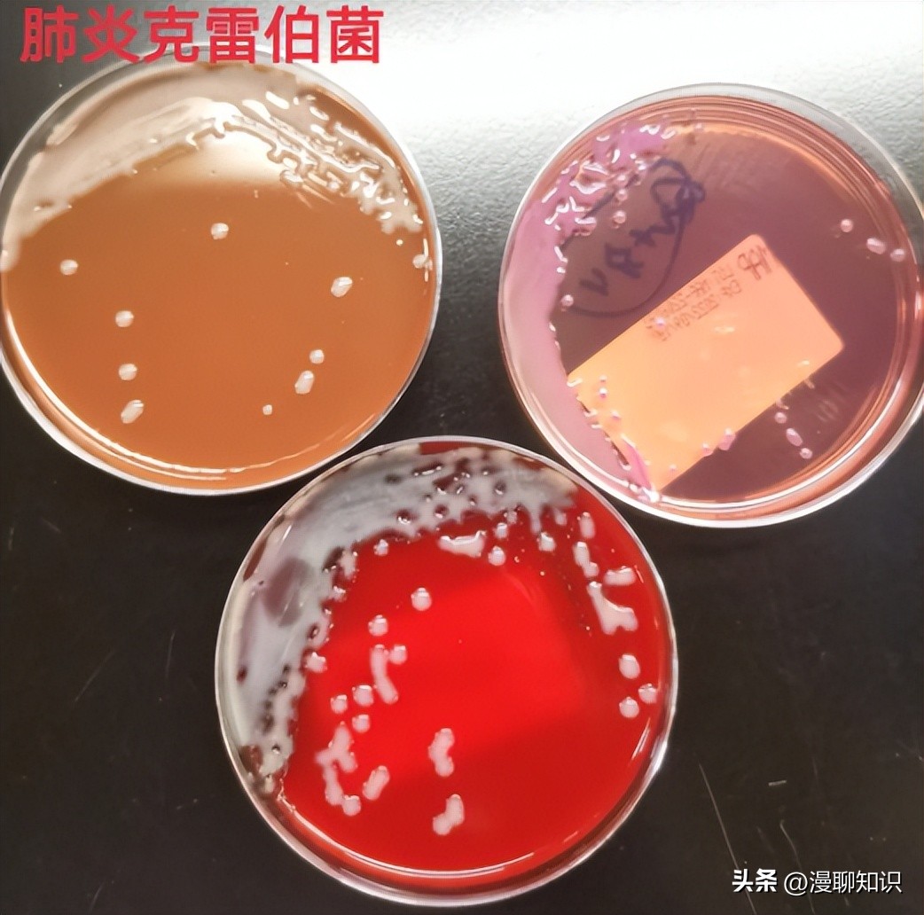 老年人得了肺炎应如何有效医治,肺炎有多严重怎么办