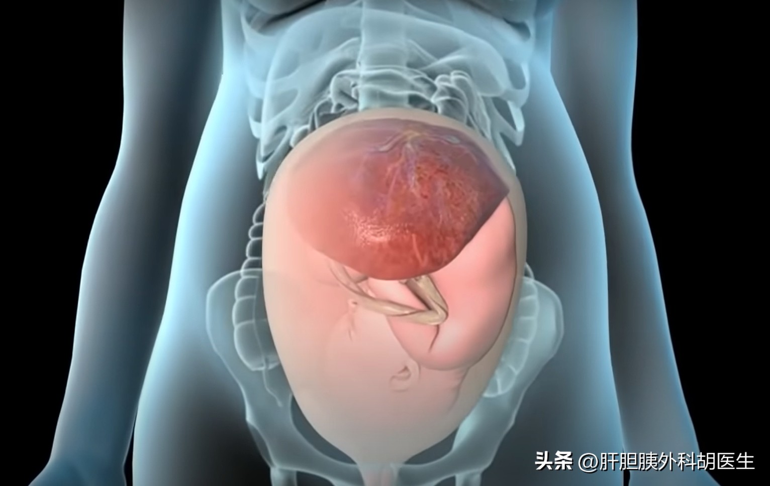 乙肝女能生出健康孩子吗,父母都有乙肝会生出健康宝宝吗