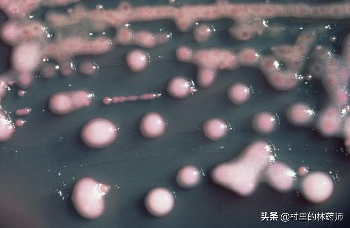 病人痰液有恶臭味是哪种细菌感染,痰液查出有细菌需要做支气管镜吗