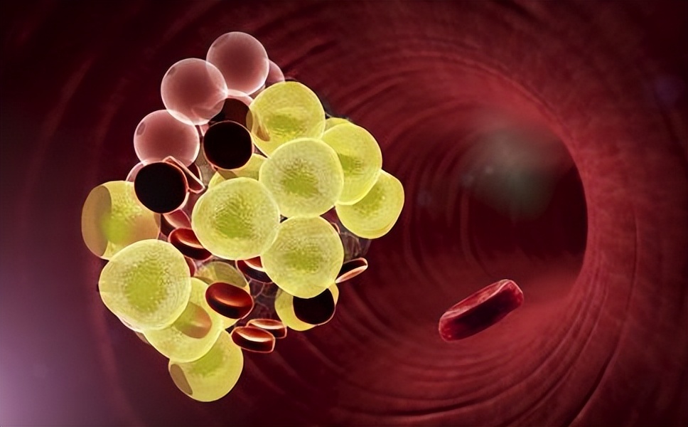 身体中转氨酶高的表现,体检转氨酶升高什么意思