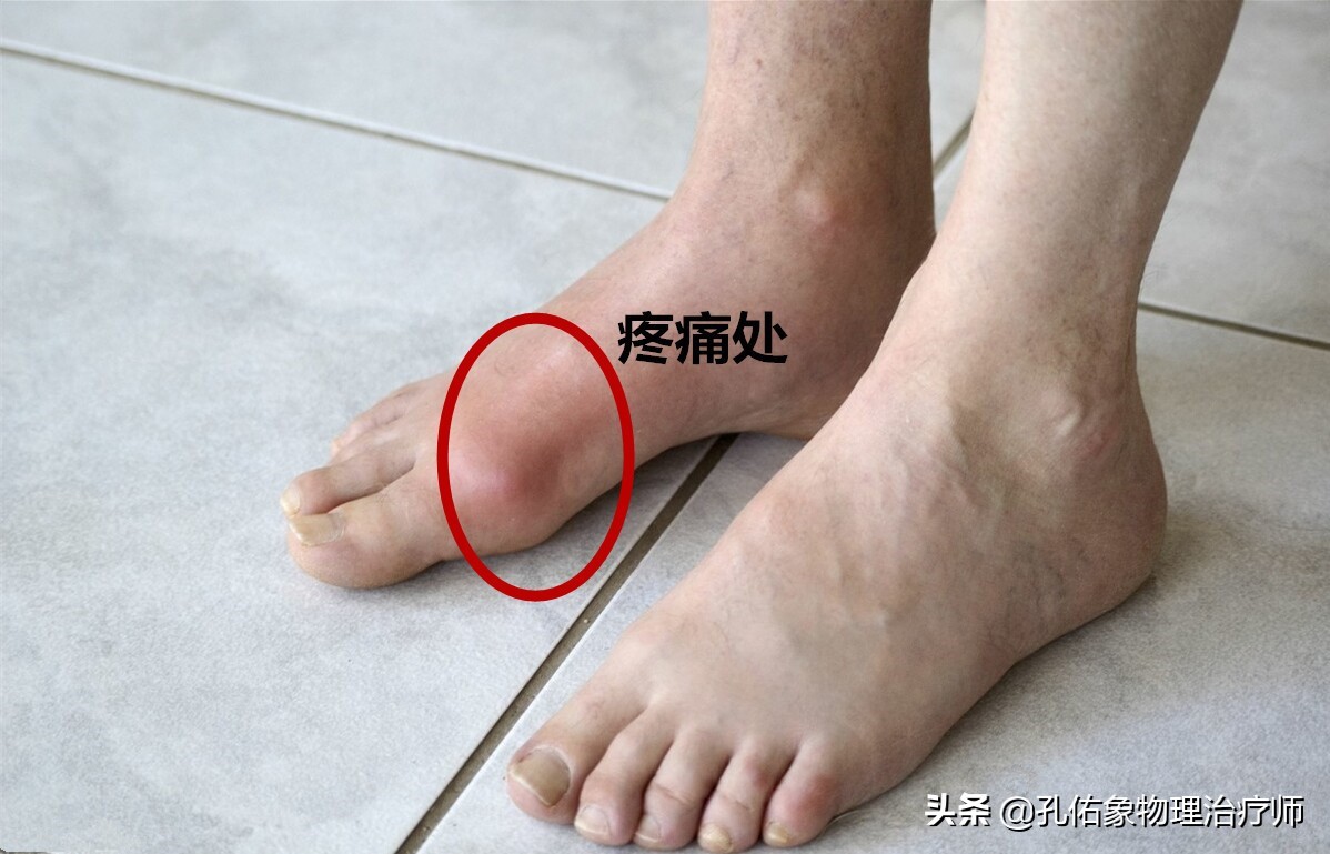 中老年人脚底痛是什么原因,老人脚底板好疼是什么原因