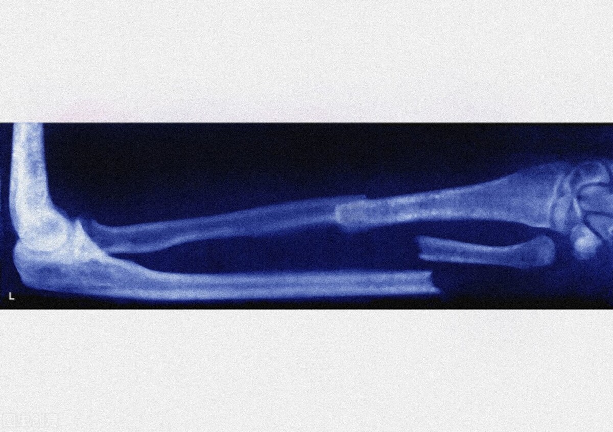 小强在跑步时候摔倒了,操场上小红不小心摔倒了