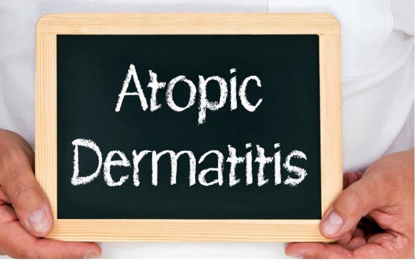 为什么特应性皮炎看似好了会复发,特应性皮炎是什么原因造成的