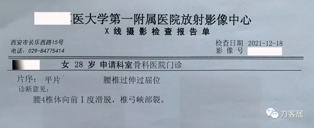 左腰峡部裂能引起右腰疼痛吗,峡部裂会腰痛吗