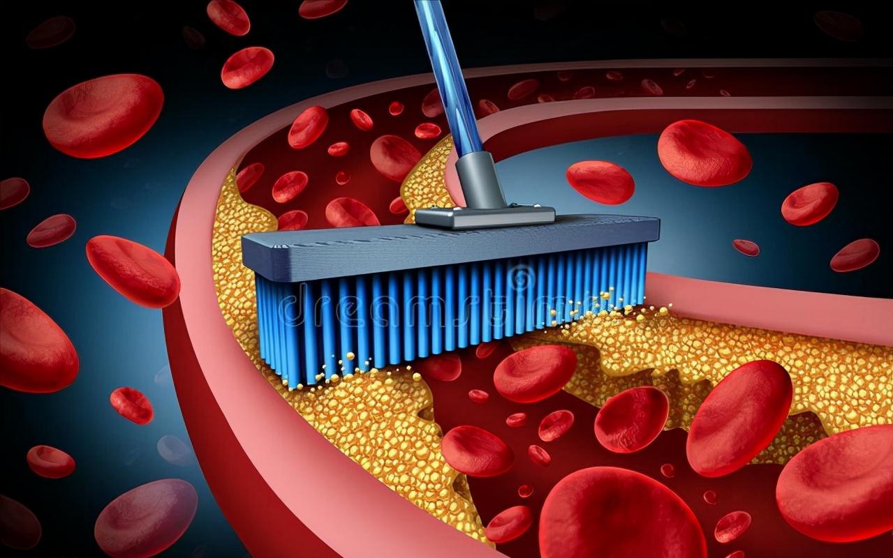 强心降脂抗动脉粥样硬化,冠心病治疗一线降脂药物