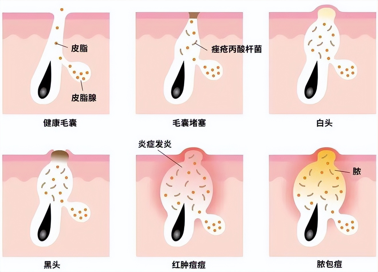 嘟嘟瓜美业门店,嘟嘟瓜美业靠谱吗