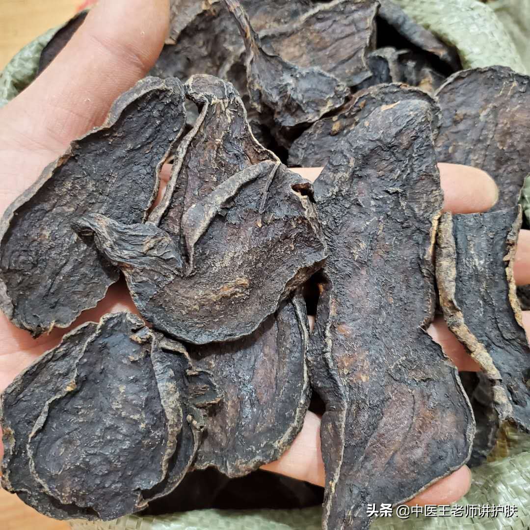 女性脂溢性脱发补肝肾气血有用吗,脂溢性脱发为什么祛风活络