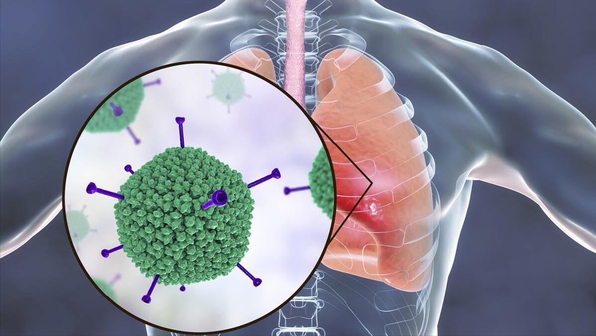 左氧氟沙星是抗菌药还是消炎药,左氧氟沙星对哪种细菌感染有用