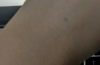 小孩儿手里扎进了铅笔芯怎么办,8岁小孩眼睛不小心被铅笔戳了