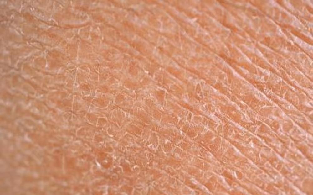 入秋皮肤痒有什么办法,秋天皮肤痒一抓起水泡怎么止痒