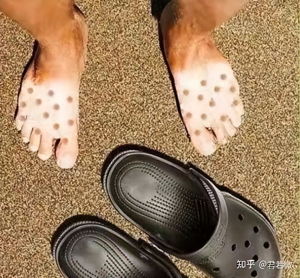 每天睡得很累是因为什么,生活太累有点撑不住了早点睡觉