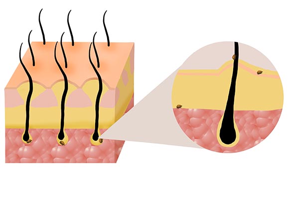身上的阴虱是怎么来的？感染后有啥感觉？刮阴毛好，还是不刮好？