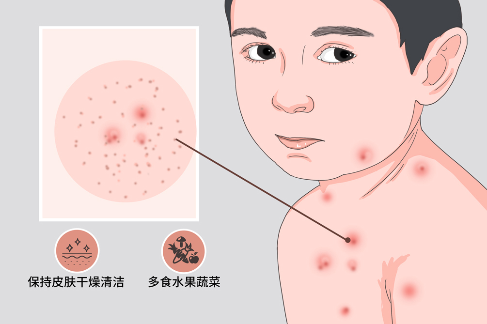 人类全身褪去毛发后，为什么只留下头发、阴毛和腋毛？