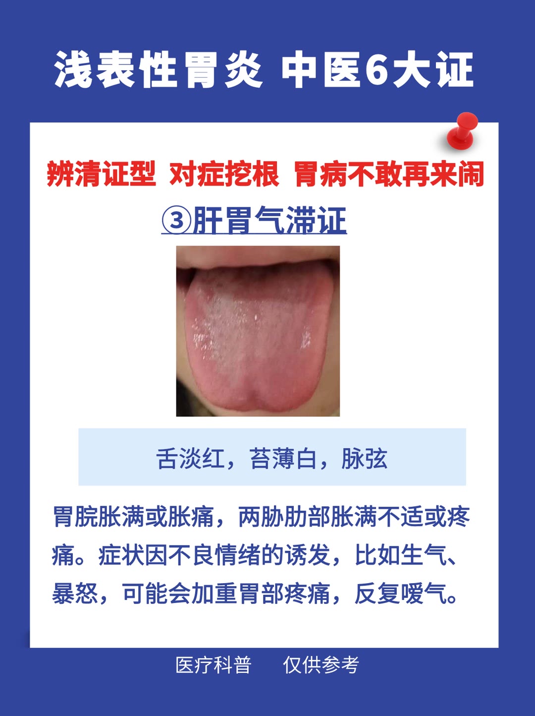 慢性浅表性胃炎中医治疗药方,浅表性胃炎中医判断