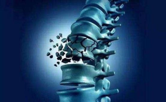 骨密度下降严重怎样系统治疗,骨密度下降用什么药好