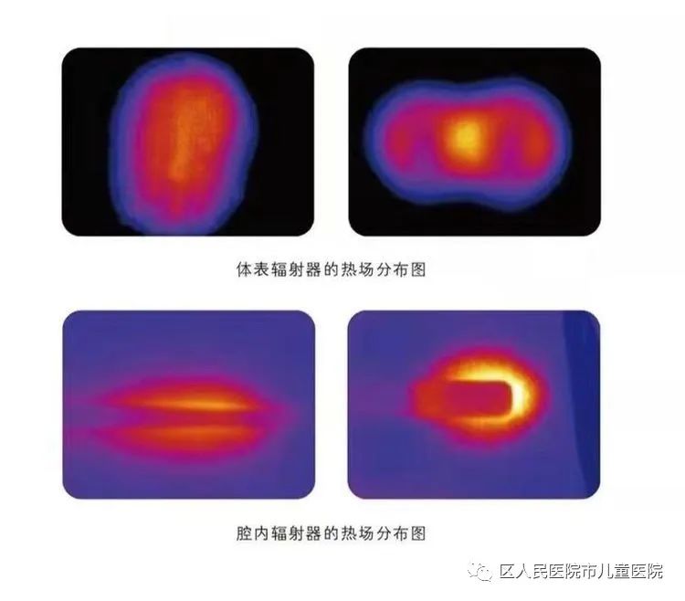 微波多功能治疗仪的功能,老年病治疗仪