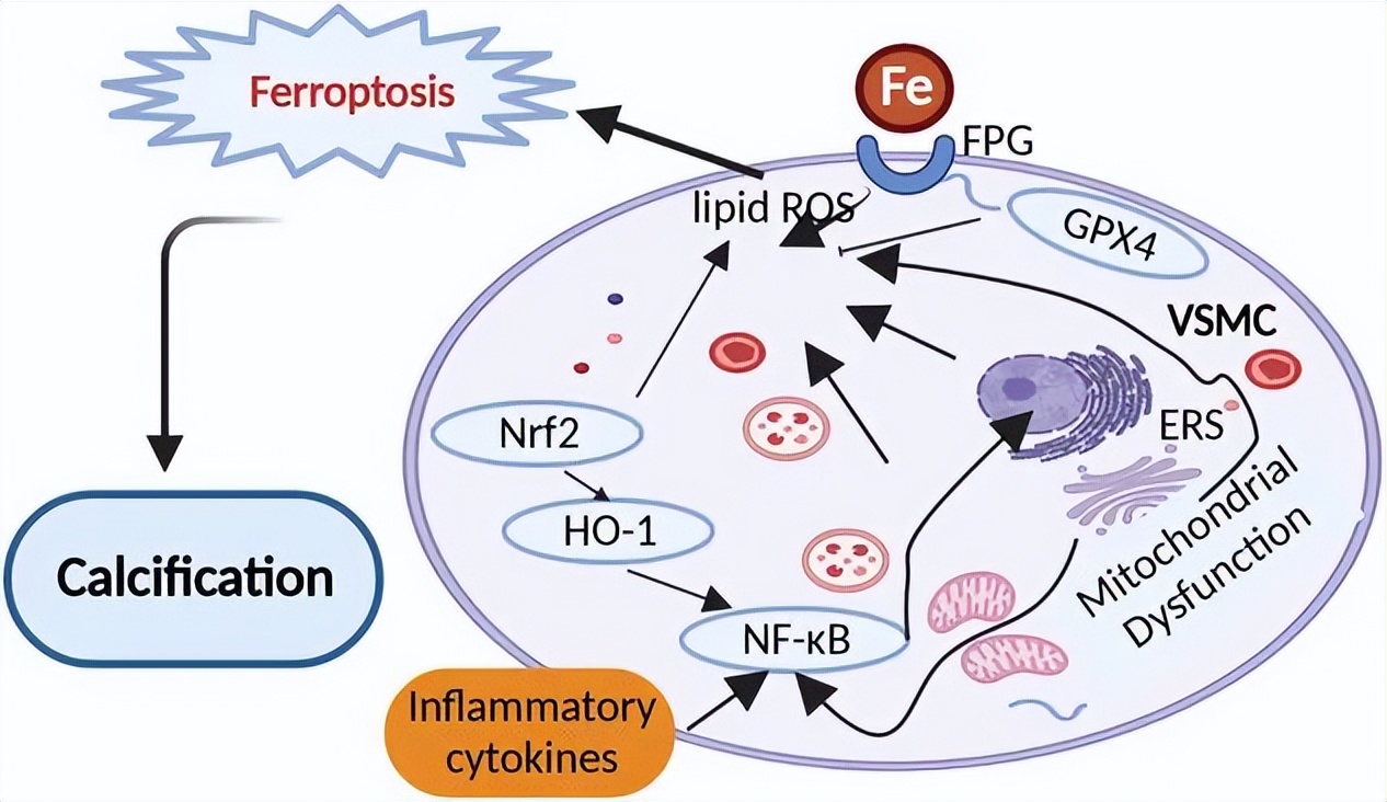 血管钙化的机制是什么,血管钙化如何治疗吃什么中成药