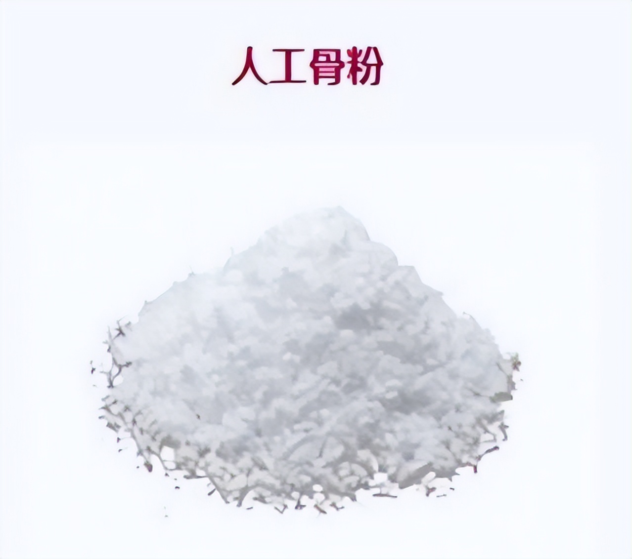 注射骨粉有什么后果,注射骨粉失败案例