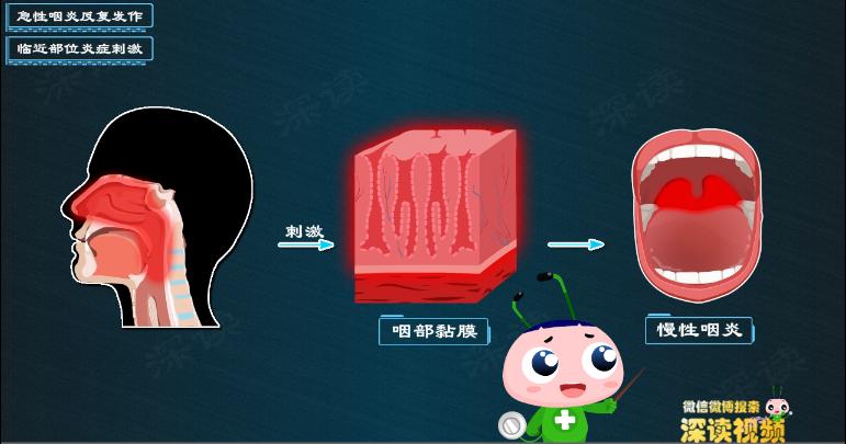 喉咙发痒恶心是怎么回事,咽炎喉咙痒干呕吃什么