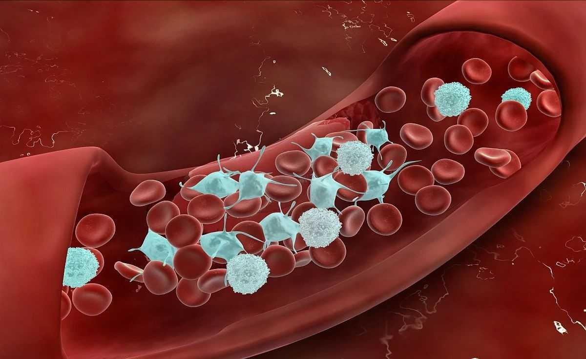 血粘稠与高血脂的区别,为什么说血稠是伪科学呢