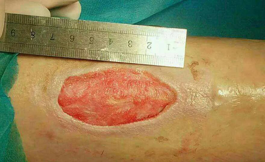 几块钱一瓶的维生素b2好用吗,维生素b2几块钱的能用吗