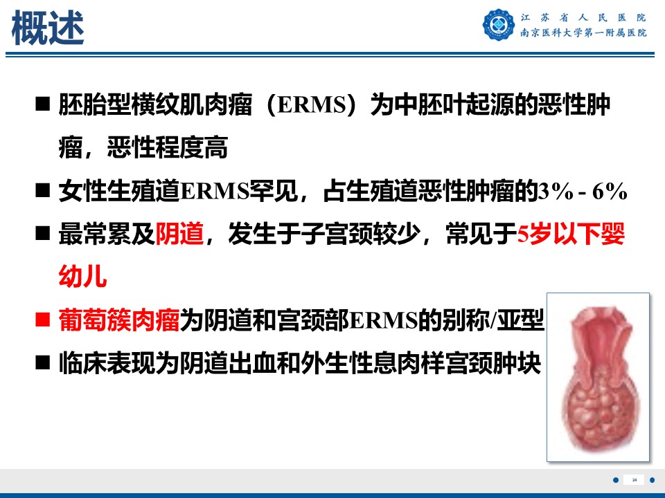 好文分享——《胚胎型横纹肌肉瘤》