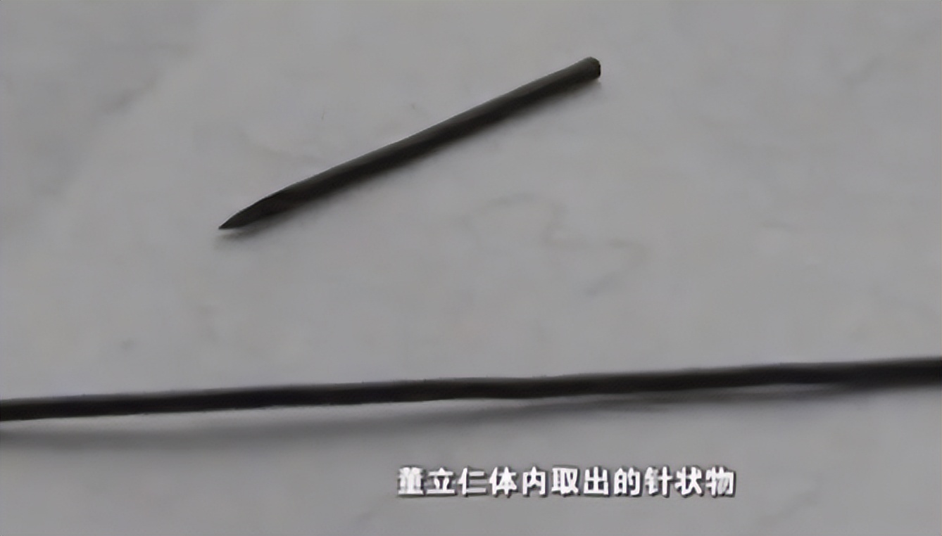 17岁男孩头痛被送进医院，医生一看X光片直接傻眼：没救了