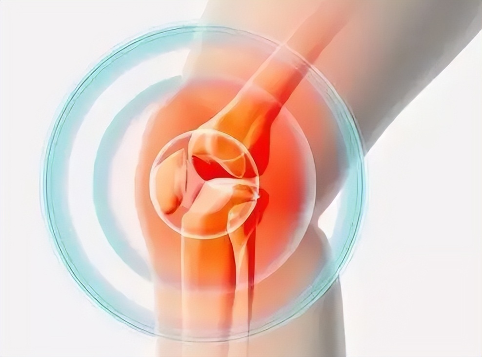 膝关节滑膜炎用滑膜炎药膏行吗,膝关节滑膜炎最佳治疗方法有哪些