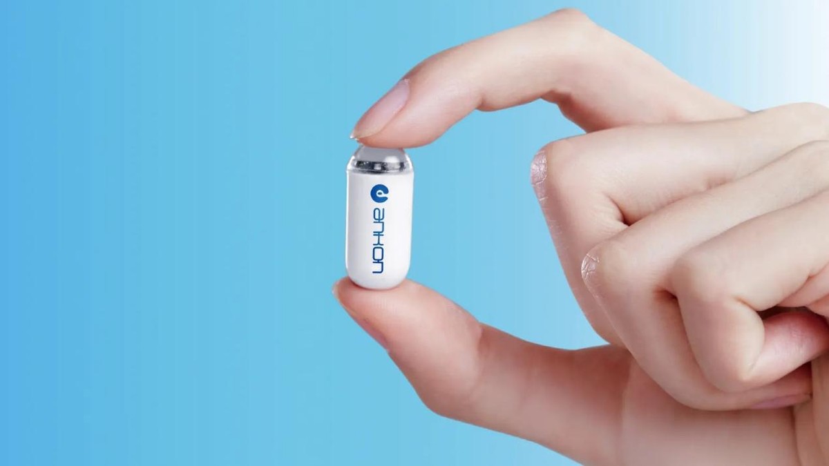 安翰磁控胶囊胃镜技术,安翰磁控胶囊胃镜禁忌症