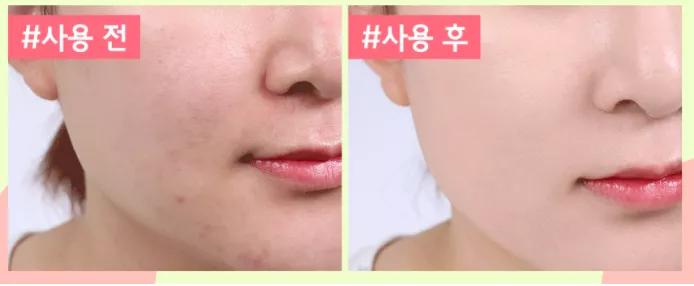 韩国化妆品销量排行榜最新,韩国药妆排行