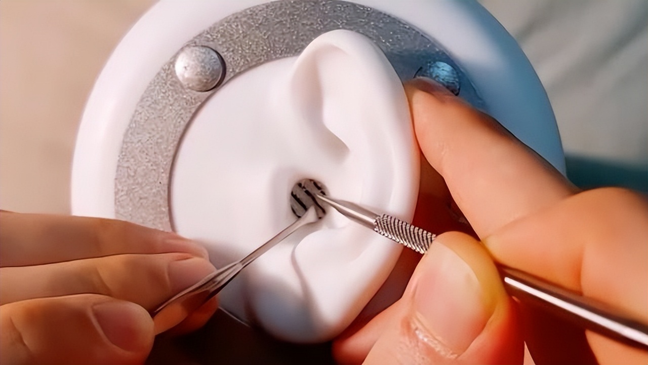 为什么有人耳屎是干的有的是湿的,为啥有人的耳屎是湿的