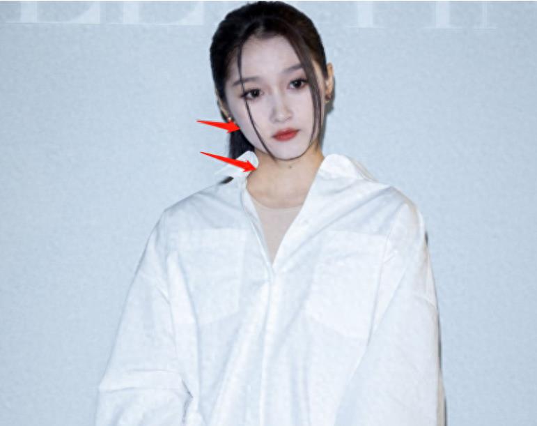 瘦到病态的审美,瘦到病态